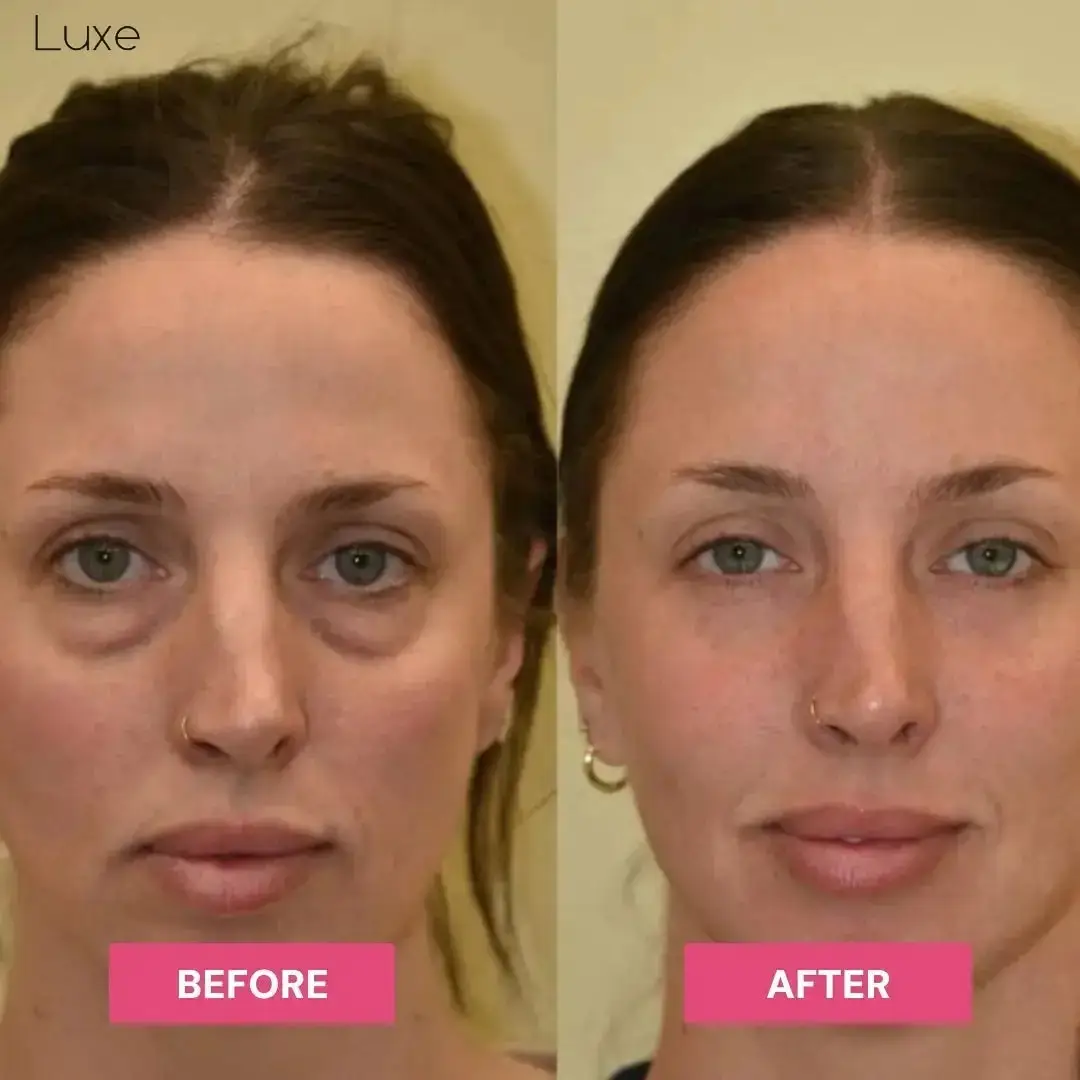 Luxe | Korean Under-Eye Balm - Image 4
